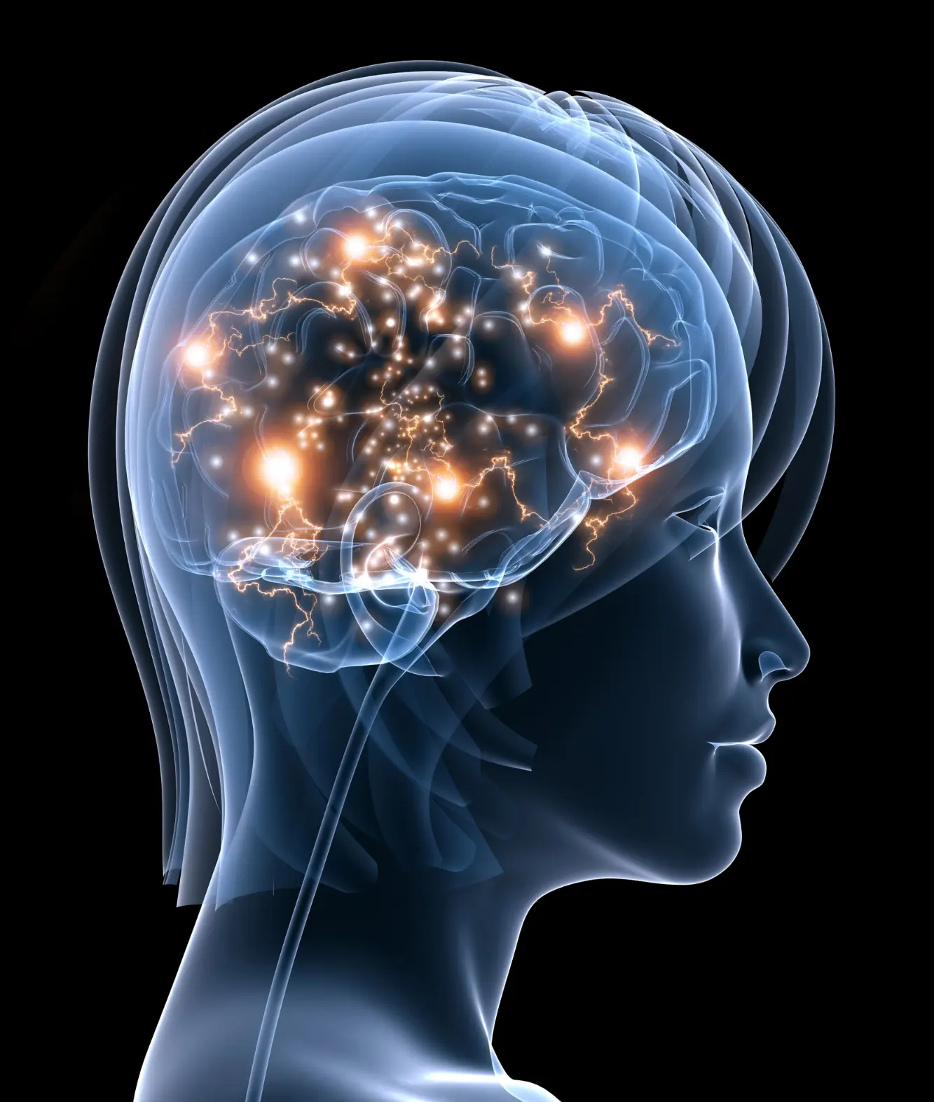 Image d'une activation cérébrale
