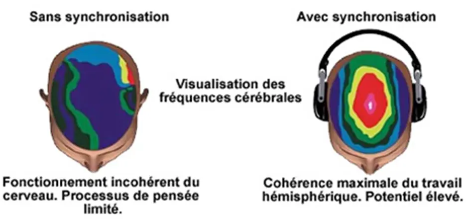Image d'une synchronisation des deux hémisphère cérébraux